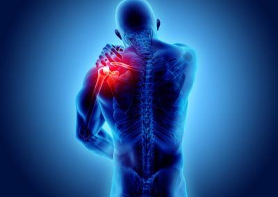 Treating Shoulder Pain