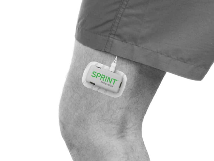 SPRINT PNS device on knee